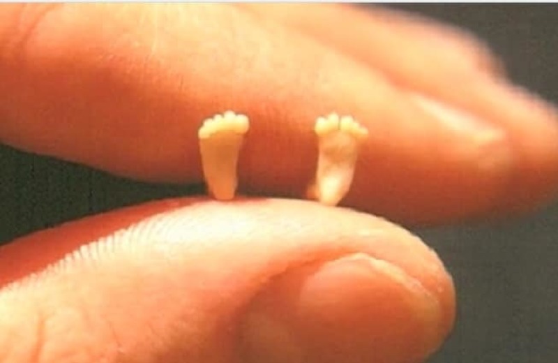 The foot of the fetus at 10 weeks with perfect wrinkles